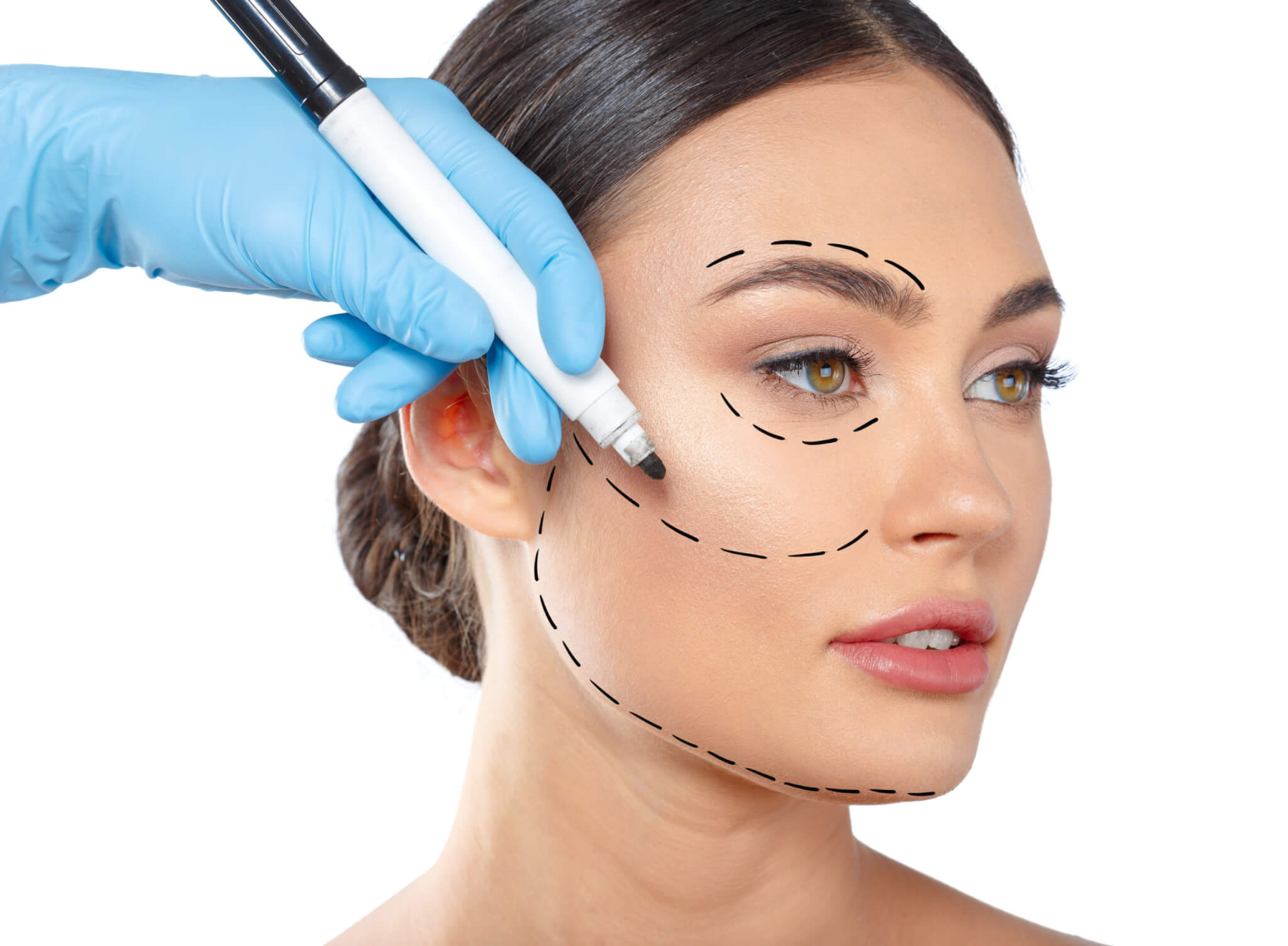The Procedure That Can Help Give You Dimples